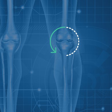 Robotic Knee Replacement